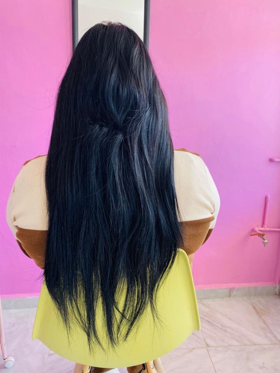 Antes — Nanoplastia